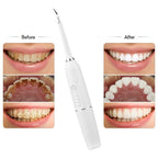 Kit Profesional de Higiene Dental 5 en 1 / Limpieza más completa en casa
